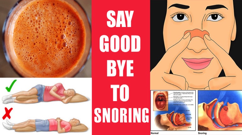 How to stop snoring naturally